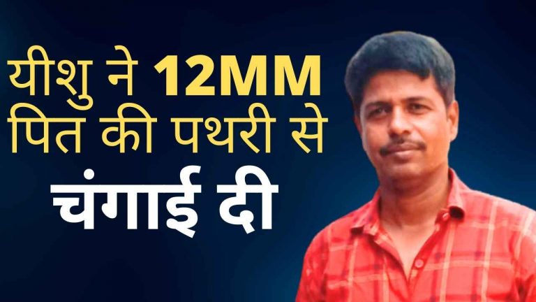 Read more about the article यीशु मसीह ने मुझे 12MM पित की पथरी से चंगाई दी